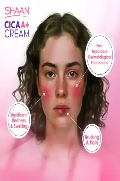 Shaan Cica Cream