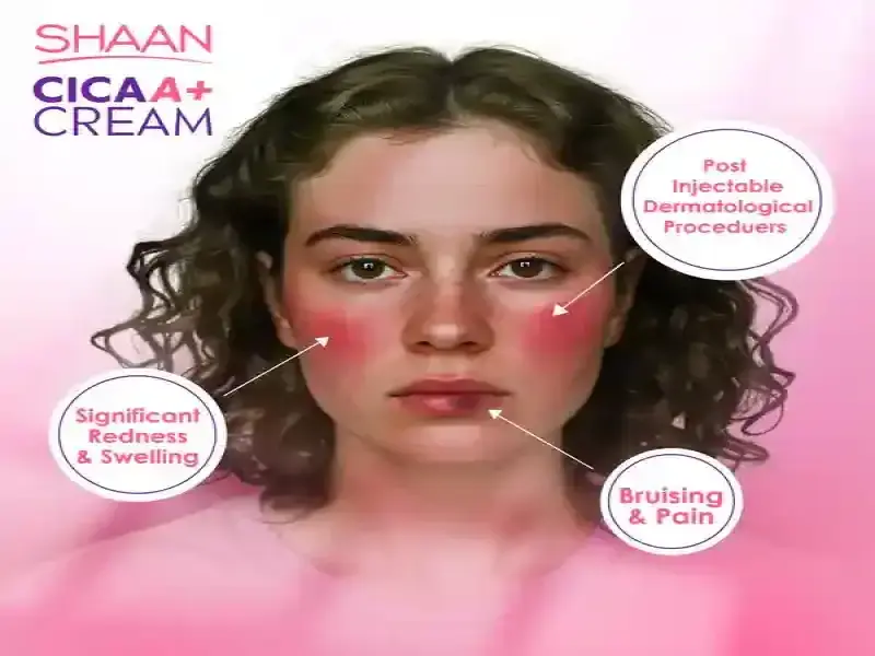 Shaan Cica Cream